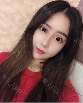 Ϻ氮